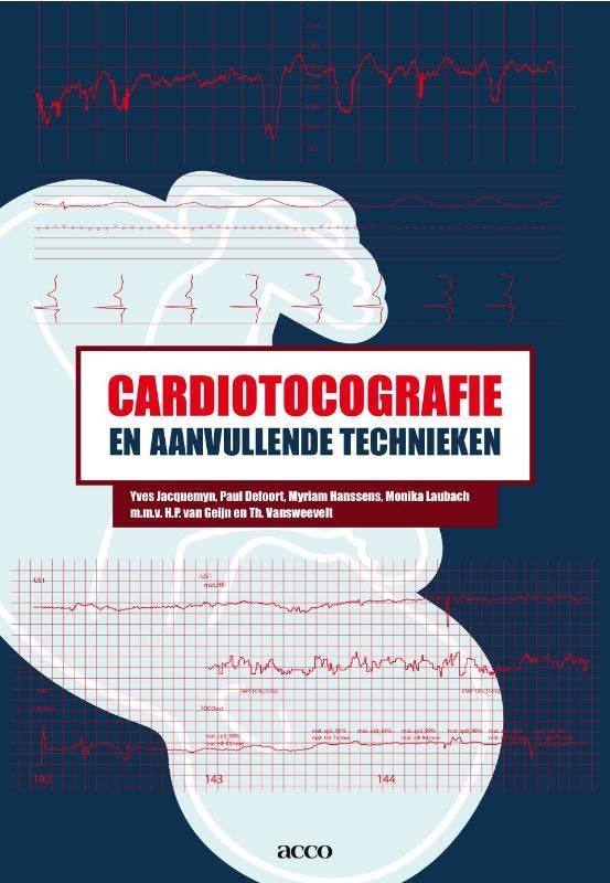 Cardiotocografie en aanvullende technieken 9789033476273, Livres, Science, Envoi