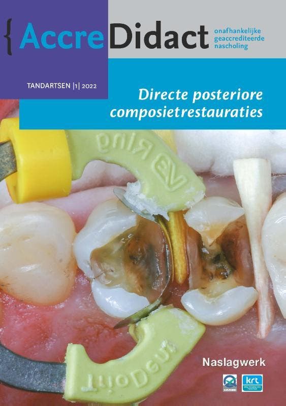 Directe posteriore composietrestauraties / AccreDidact /, Boeken, Wetenschap, Zo goed als nieuw, Verzenden