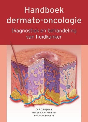 Handboek dermato-oncologie 9789490826406 Rob Beljaards, Livres, Verzenden, Rob Beljaards