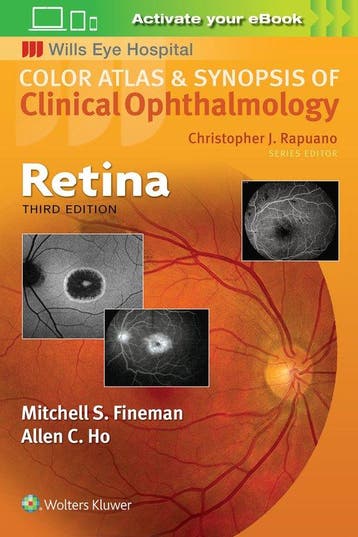 Retina 9781496363084 Mitchell Fineman, Boeken, Verzenden, Zo goed als nieuw, Mitchell Fineman