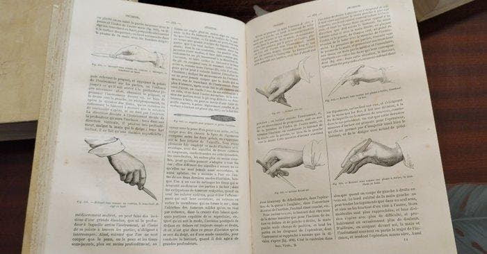Hurtrel dArboval - Dictionnaire de médecine, de chirurgie, Antiquités & Art, Antiquités | Livres & Manuscrits