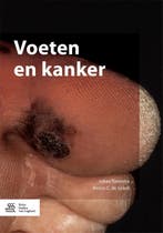 Voeten en kanker 9789036810708 Johan Toonstra, Verzenden, Gelezen, Johan Toonstra