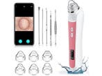 Twenty4seven® Mee-eter Verwijderaar - Blackhead Remover Set, Verzenden