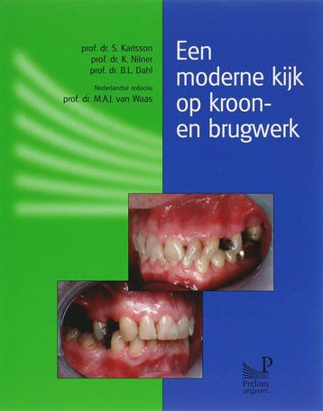 Een moderne kijk op kroon- en brugwerk 9789085620198, Verzenden, Gelezen