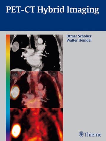 PET-CT Hybrid Imaging 9783131488619 Otmar Schober, Boeken, Verzenden, Zo goed als nieuw, Otmar Schober