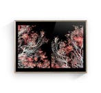 Susana Galbis - The hug of trees - XL