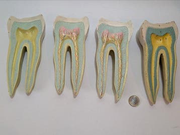 Anémomètre (2) - Composite - 1950-1960 - Dents