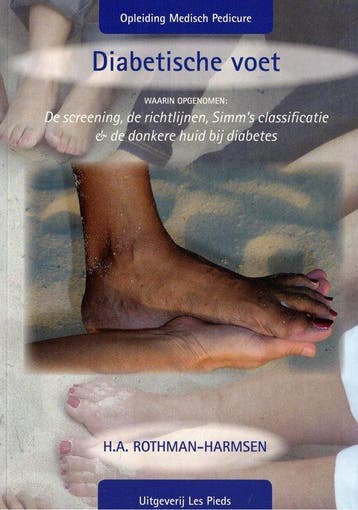 Diabetische voet 9789082161014 Rothman-Harmsen, Verzenden, Gelezen, Rothman-Harmsen