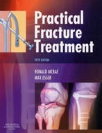 Practical Fracture Treatment 9780443068768 Ronald McRae, Verzenden, Ronald McRae
