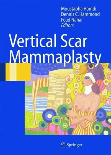Vertical Scar Mammaplasty 9783540221012 Dennis C. Hammond, Verzenden, Zo goed als nieuw, Dennis C. Hammond