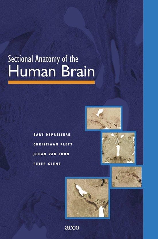Sectional anatomy of the human brain 9789033445231, Livres, Langue | Anglais, Envoi