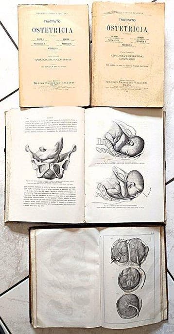 Più Autori - Lot with 4 books on Obstetrics - 1841-1924
