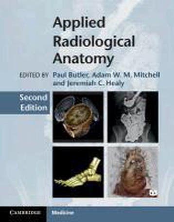 Applied Radiological Anatomy 9780521766661, Verzenden, Zo goed als nieuw, University Paul Butler