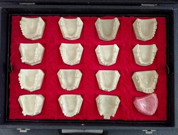 1970s Ruthinium maletín odontología • Moldes dentales