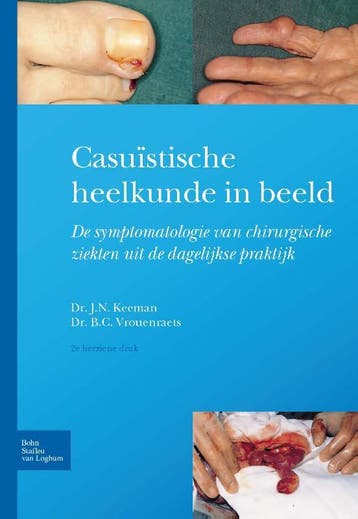 Casuistische heelkunde in beeld 9789031392285 J.N. Keeman, Boeken, Verzenden, Zo goed als nieuw, J.N. Keeman