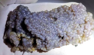 Grape Agate van hoge kwaliteit!! AAA Geen reserveprijs- 175