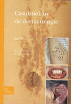 Casuïstiek in de dermatologie 9789031384570 A.C. Groot, Verzenden, Gelezen, A.C. Groot