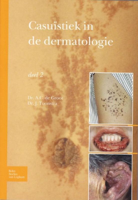 Casuïstiek in de dermatologie 9789031384570 A.C. Groot, Livres, Science, Envoi