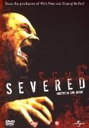 Severed op DVD, Verzenden