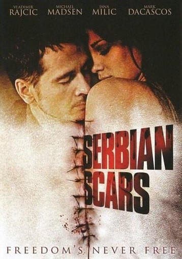 Serbian scars (dvd tweedehands film), Ophalen of Verzenden, Nieuw in verpakking