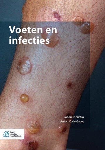 Voeten en infecties 9789036829168 Johan Toonstra, Verzenden, Gelezen, Johan Toonstra