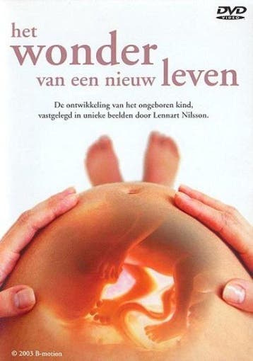 Het wonder van een nieuw leven  (dvd tweedehands film), Ophalen of Verzenden, Nieuw in verpakking