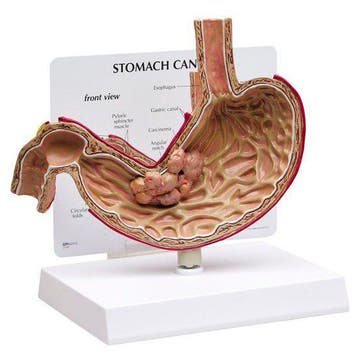 Anatomisch maagmodel pathologie ST-ATM 78, Verzenden, Nieuw