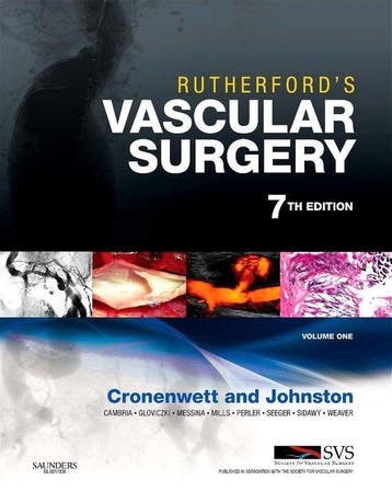 Rutherfords Vascular Surgery, 2-Volume Set 9781416052234, Verzenden, Jack Cronenwett
