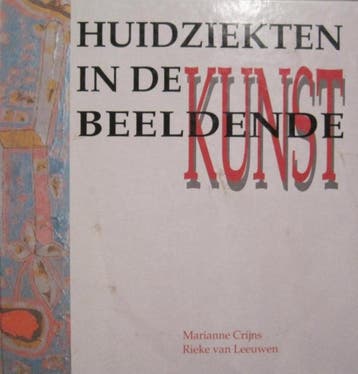 Huidziekten in de beeldende kunst 9789071941191 Cryns, Verzenden, Gelezen, Cryns