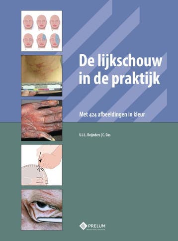 De lijkschouw in de praktijk 9789085621508 U.J.L. Reijnders, Boeken, Verzenden, Zo goed als nieuw, U.J.L. Reijnders