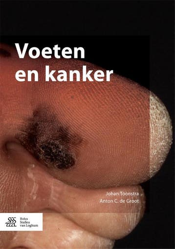 Voeten en kanker 9789036810708 Johan Toonstra, Boeken, Verzenden, Zo goed als nieuw, Johan Toonstra