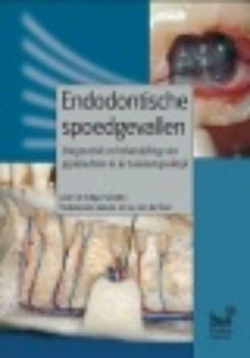 Endodontische spoedgevallen 9789085620631 Edgar Schäfer, Verzenden, Edgar Schäfer