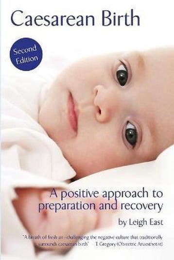 Caesarean Birth 9780956848024 Leigh East, Verzenden, Gelezen, Leigh East