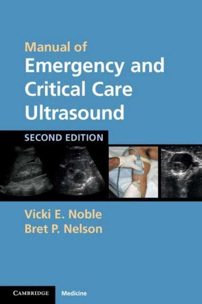 Manual of Emergency and Critical Care Ultrasound Vicki Noble, Boeken, Taal | Engels, Gelezen, Verzenden