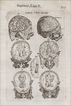 GUILLEMEAU (Jacques). - Les oeuvres de chirurgie... - 1649