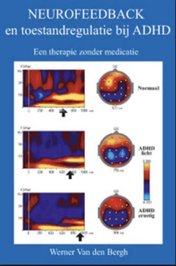 Neurofeedback en toestandregulatie bij ADHD 9789079094011, Verzenden, Gelezen, W. Van den Bergh