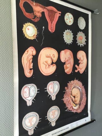 Röhl - Deushe gesundheids museum Köln - Oude anatomische