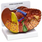 Anatomisch model leverpathologie ST-ATM 90, Verzenden, Nieuw