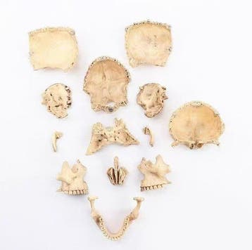mens human Taxidermie replica montage - Human Skull