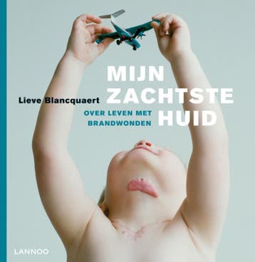Mijn zachtste huid 9789020986143 Lieve Blancquaert, Verzenden, Gelezen, Lieve Blancquaert
