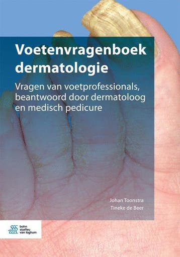 Voetenvragenboek dermatologie 9789036818247 Tineke de Beer, Verzenden, Gelezen, Tineke de Beer