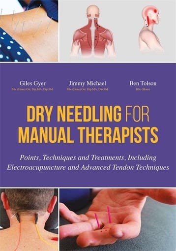 Dry Needling for Manual Therapists 9781848192553 Giles Gyer, Verzenden, Gelezen, Giles Gyer