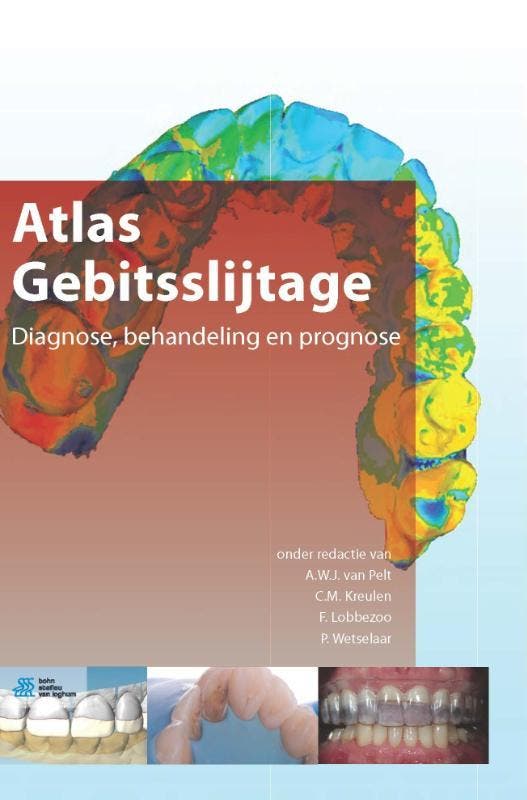 Atlas gebitsslijtage 9789036805377, Livres, Science, Envoi