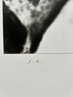 Christian Schad (1894–1982) - Neuer Tum