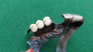 Instrument médical - Argent 925 - Prothèse dentaire