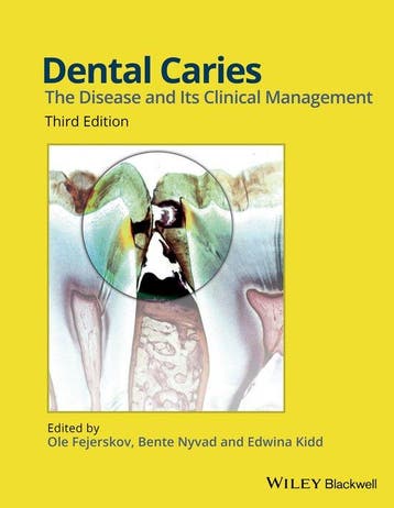 Dental Caries 3rd Edition 9781118935828 Ole Fejerskov, Verzenden, Zo goed als nieuw, Ole Fejerskov