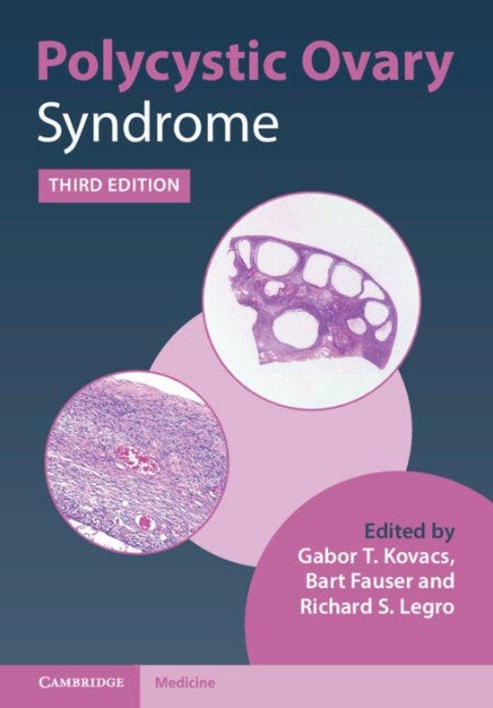 Polycystic Ovary Syndrome 9781108839334 Gabor T. Kovacs, Livres, Langue | Anglais, Envoi