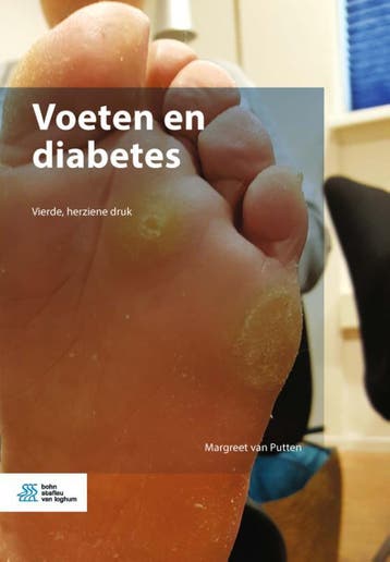 Voeten en diabetes 9789036802789 Margreet van Putten, Verzenden, Zo goed als nieuw, Margreet van Putten
