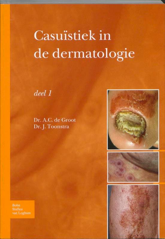 Casuïstiek in de dermatologie / deel 1 9789031361885, Boeken, Wetenschap, Gelezen, Verzenden
