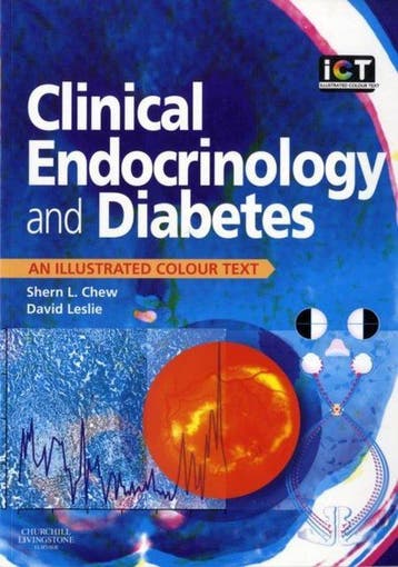 Clinical Endocrinology and Diabetes 9780443073038 Shern Chew, Verzenden, Gelezen, Shern Chew